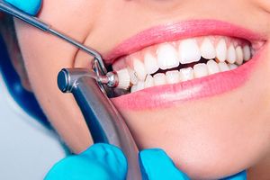 Skilled teeth cleaning is an important hygienic service