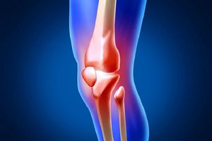 Що краще за МРТ або КТ колінного суглоба?