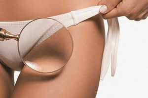 Laser epilation of the bikini area: What is it and how does it work?