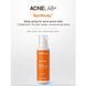 Body spray for acne-prone skin Spotbody Body spray for acne-prone skin ACNELAB+ 150 ml №3