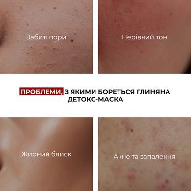 Glinkowa maska ​​detoksykująca do sk&oacute;ry problematycznej Przeciwtrądzikowa i detoksykująca z glinką Hillary 90 ml