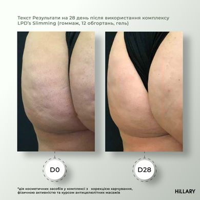 Набір Антицелюлітні ліпосомальні обгортання + рідина Anti-cellulite LPD'S Slimming (6 процедур) Hillary